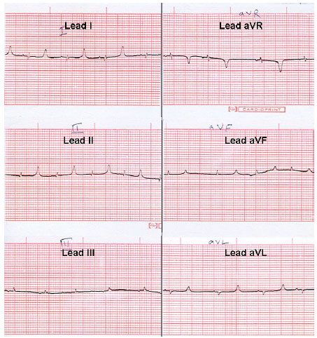 Image for - Electrocardiographic Studies in Garol Sheep and Black Bengal Goats