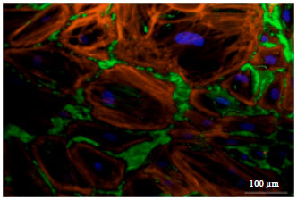 Image for - Validation of Various Standard Strategies for Fluorescence Image Denoising of Cardiac Fibroblast Cells