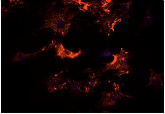 Image for - Validation of Various Standard Strategies for Fluorescence Image Denoising of Cardiac Fibroblast Cells