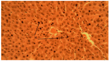 Image for - Methanolic Root Extract of Olax viridis Protects the Liver against Acetaminophen-induced Liver Damage