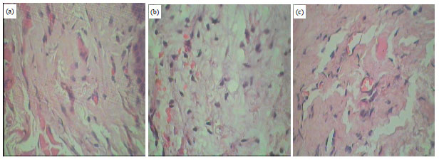Image for - Effectiveness of Noni (Morinda citrifolia L.) Leaves Extract  Gel as Standardized Traditional Medicine to Accelerate Oral Mucosa Wound Healing  on Wistar Rats