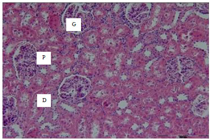 Image for - Effects of Aqueous-ethanolic Extract of Nigella sativa Seeds (Black Cumin) and Vitamin E on Cisplatin-induced Nephrotoxicity in Rat
