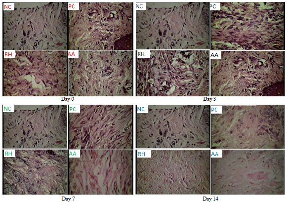 Image for - Effect of Rambutan-honey and its Flavonoid on TGF-β1 Induce Fibroplasia Oral Wound Healing