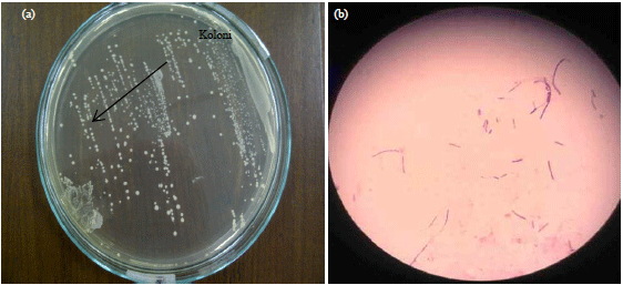 Image for - Effect of Munghurt Lactobacillus acidophilus from Green Beans to Blood Glucose Levels in Alloxan-induced Diabetic Rats