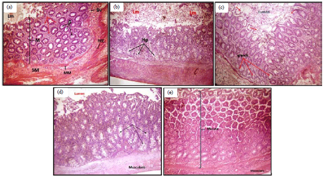 Image for - Intestinal Histological Evaluation and Antidiarrhoeal Effect of Allium sativum Juice in Experimentally Induced Diarrhoea in Rats