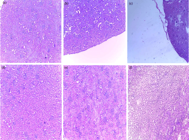 Image for - Hepatoprotective and Nephroprotective Potency of Ricinodendron heudelotii Against Acetaminophen-induced Toxicity in Wistar Albino Rats
