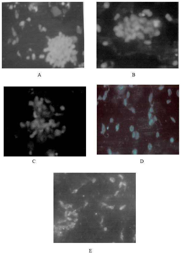 Image for - Radiation Induced Alterations in Membrane Fluidity, Microtubular Structure, Glycoconjugates and Protein in Leishmania donovani