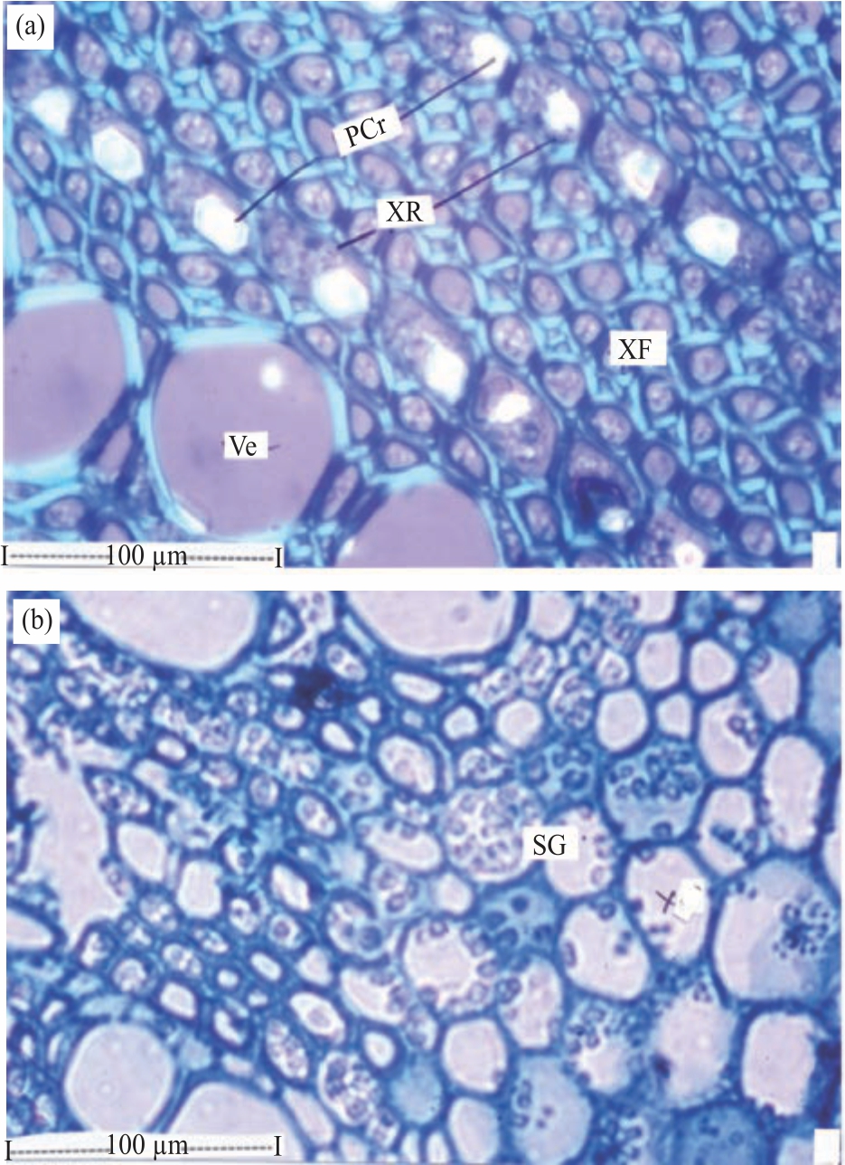 Image for - Pharmacognostical and Phytochemical Analysis of Stems of Vitex pinnata Linn.