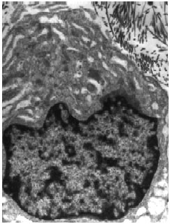 Image for - Zerumbone`s Effect on Major Histocompatibility Complex Type II Cells in Synovial Membrane of OsteoArthritic Joint
