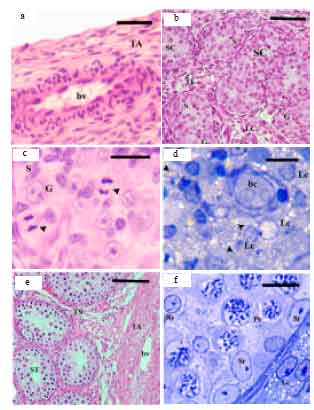 Image for - Histological and Histomorphometric Changes of the Rabbit Testis During Postnatal Development