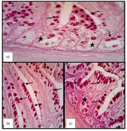 Image for - Histomorphological and Histochemical Study of the Small
Intestine of the Striated Scope Owls (Otus Scors Brucei)