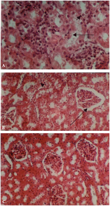 Image for - The Possible Role of Interstitial Stem Cells Potential for Correcting Histopathological Changes in Liver and Kidney of Rats after Copper Toxicity