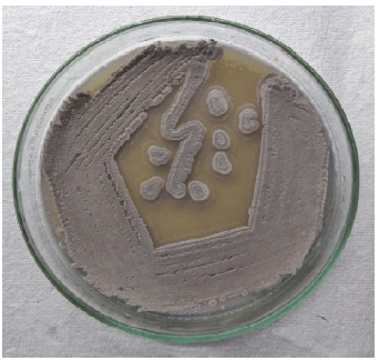 Image for - Streptomyces Mediated Synthesis of Copper Oxide Nanoparticles (CuO-NPs) and its Activity Against Malassezia furfur