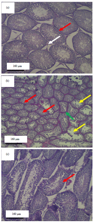 Image for - Histomorphometric Assessment of Seminiferous Tubules from Streptozotocin-nicotinamide-induced Diabetic Rats Treated with Unsweetened Theobroma cacao Powder