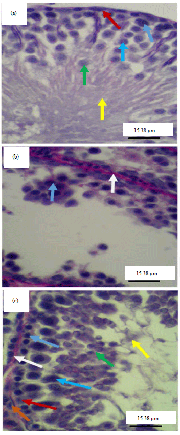Image for - Histomorphometric Assessment of Seminiferous Tubules from Streptozotocin-nicotinamide-induced Diabetic Rats Treated with Unsweetened Theobroma cacao Powder