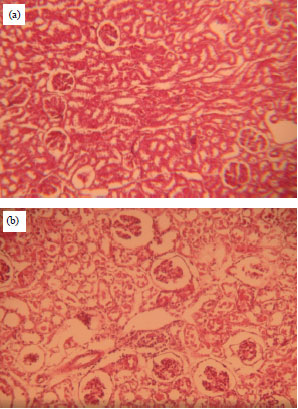 Image for - Nephroprotective Activity of Capparis decidua Aerial Parts Methanolic Extract in Wistar Albino Rats