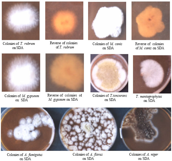 Image for - Incidence of Dermatophytes and Other Keratinolytic Fungi in the Soil of Amravati (India)