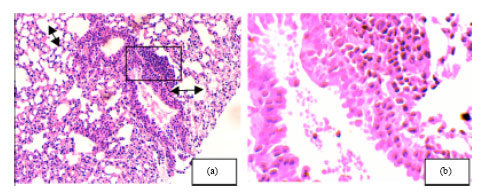 Image for - Tumor Lung Cancer Model for Assessing Anti-neoplastic Effect of PMF in Rodents: Histopathological Study
