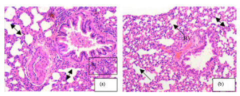 Image for - Tumor Lung Cancer Model for Assessing Anti-neoplastic Effect of PMF in Rodents: Histopathological Study
