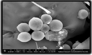 Image for - Biosynthesized Silver Nanoparticles (AgNPs) by the Two-spotted Spider Mite Tetranychus urticae Against the Cotton Leafworm (Spodoptera littoralis)