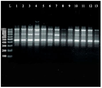 Image for - Molecular Analysis of RAPD-PCR Genomic Patterns in Age Related Acute Myeloid  Leukemia