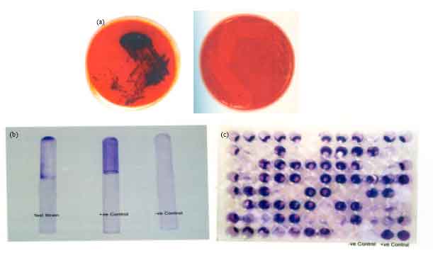 Image for - Detection of Biofilm Formation in Staphylococcus aureus. Does it have a role in Treatment of MRSA Infections?