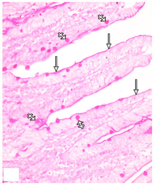 Image for - Protective Effect of Omega-3 Fatty Acids on 5-fluorouracil-induced Small  Intestinal Damage in Rats: Histological and Histomorphometric Study