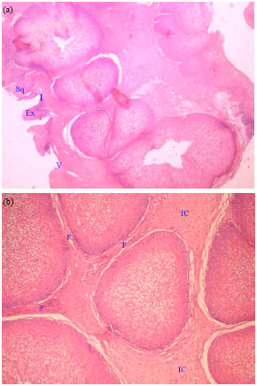 Image for - Applicability of Biomarkers for Differentiation of Inverted Papilloma Assigned for Endoscopic Surgery