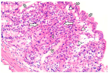 Image for - Protective Effect of Omega-3 Fatty Acids on 5-fluorouracil-induced Small  Intestinal Damage in Rats: Histological and Histomorphometric Study