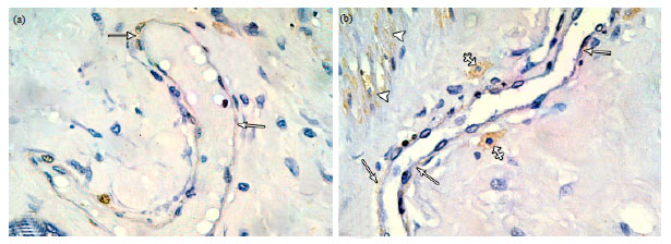 Image for - Immunohistochemical and Ultra Structural Study of Mammary Myoepithelial Cells in Pregnant and Lactating Rats