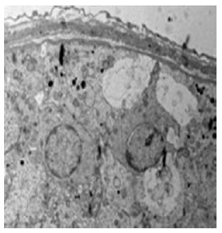 Image for - Effect of Vitamin E Supplementation on Testicular Tissues of Mice Exposed to Sub-chronic Lead Intoxication