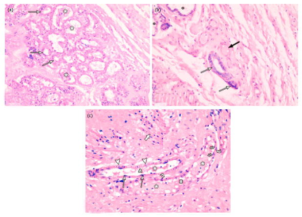 Image for - Immunohistochemical and Ultra Structural Study of Mammary Myoepithelial Cells in Pregnant and Lactating Rats