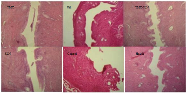 Image for - Effect of Tamoxifen Capsulated in Nanoparticles on Serum Antioxidant in Female Wistar Ovariectomized Rats
