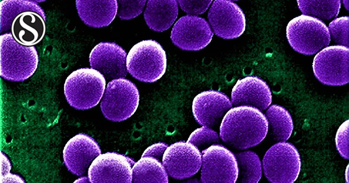 Antimicrobial Resistance Pattern of Staphylococcus aureus Strains ...